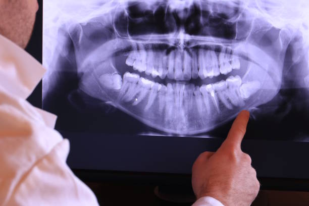 Best Broken Tooth Emergency  in Strathmore, CA